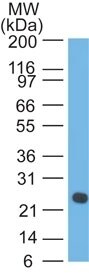 Lambda Light Chain Antibody (SPM559) - IHC-Prediluted Western Blot: Lambda Light Chain Antibody (SPM559) - IHC-Prediluted [NBP2-45076] -