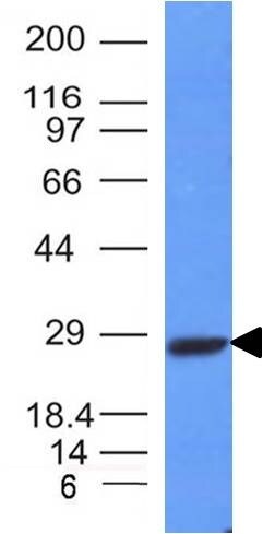 Kappa Light Chain Antibody (HP6053 + L1C1) - IHC-Prediluted Western Blot: Kappa Light Chain Antibody (HP6053 + L1C1) - IHC-Prediluted [NBP2-45085] -