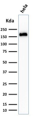 Podocalyxin Like Antibody (3D3) - IHC-Prediluted Western Blot: Podocalyxin Like Antibody (3D3) - IHC-Prediluted [NBP2-45167] -