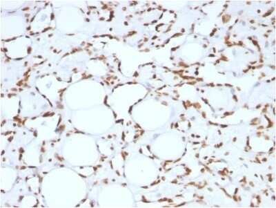 Histone H1 Antibody (HH1/957)