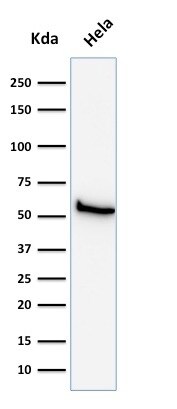 Mitochondria Antibody (113-1) - IHC-Prediluted Western Blot: Mitochondria Antibody (113-1) - IHC-Prediluted [NBP2-45195] -