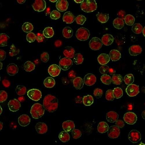 HLA DRB1 Antibody (SPM289) Immunocytochemistry/ Immunofluorescence: HLA DRB1 Antibody (SPM289) [NBP2-45311] -