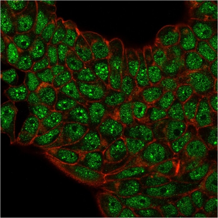 SUMO2/3 Antibody (SM23/496) - IHC-Prediluted Immunocytochemistry/ Immunofluorescence: SUMO2/3 Antibody (SM23/496) - IHC-Prediluted [NBP2-45335] -