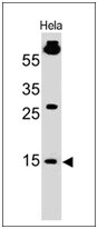 SUMO1 Antibody (SM1/495) - IHC-Prediluted Western Blot: SUMO1 Antibody (SM1/495) - IHC-Prediluted [NBP2-45337] -