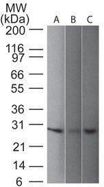 UCH-L1/PGP9.5 Antibody (31A3) - IHC-Prediluted Western Blot: UCH-L1/PGP9.5 Antibody (31A3) - IHC-Prediluted [NBP2-45339] -