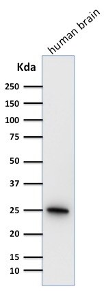 UCH-L1/PGP9.5 Antibody (31A3) - IHC-Prediluted Western Blot: UCH-L1/PGP9.5 Antibody (31A3) - IHC-Prediluted [NBP2-45339] -