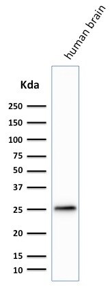 UCH-L1/PGP9.5 Antibody (SPM574) - IHC-Prediluted Western Blot: UCH-L1/PGP9.5 Antibody (SPM574) - IHC-Prediluted [NBP2-45340] -