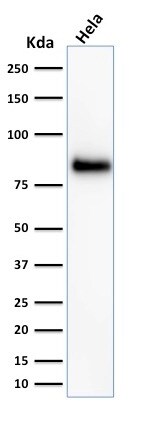 CD44 Antibody (156-3C11) - IHC-Prediluted Western Blot: CD44 Antibody (156-3C11) - IHC-Prediluted [NBP2-45346] -