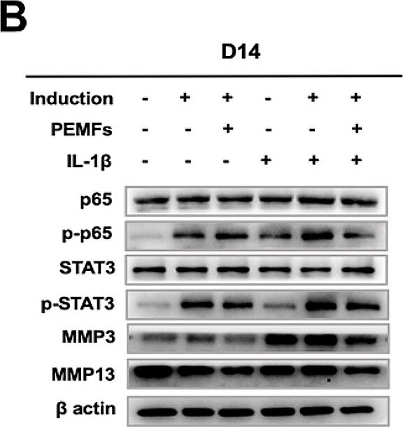 MMP-13 Antibody (OTI2D8)