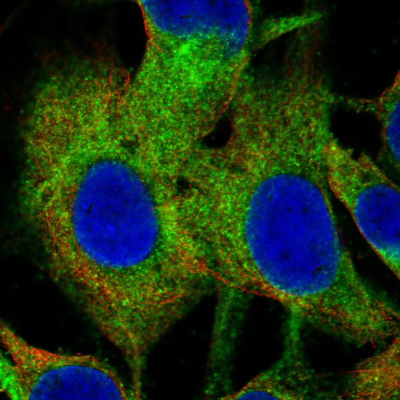 Choline Acetyltransferase/ChAT Antibody (CL3173) - BSA Free Immunocytochemistry/ Immunofluorescence: Choline Acetyltransferase/ChAT Antibody (CL3173) [NBP3-52467]