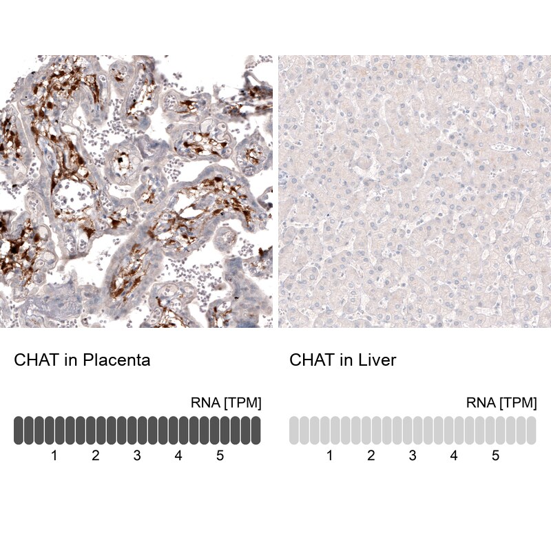 Choline Acetyltransferase/ChAT Antibody (CL3173) - BSA Free Immunohistochemistry: Choline Acetyltransferase/ChAT Antibody (CL3173) [NBP3-52467]
