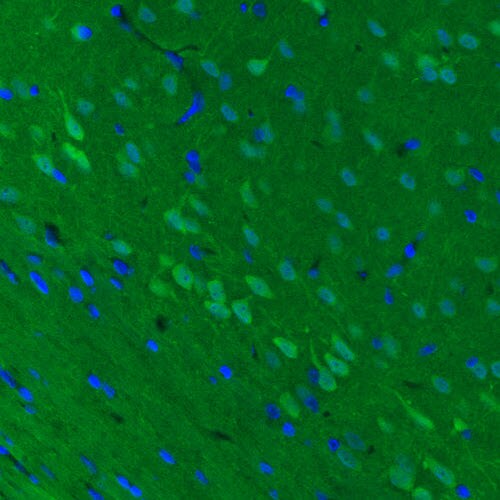 UCH-L1/PGP9.5 Antibody (CL3210) - BSA Free Immunohistochemistry-Paraffin: UCH-L1/PGP9.5 Antibody (CL3210) [NBP2-46621]
