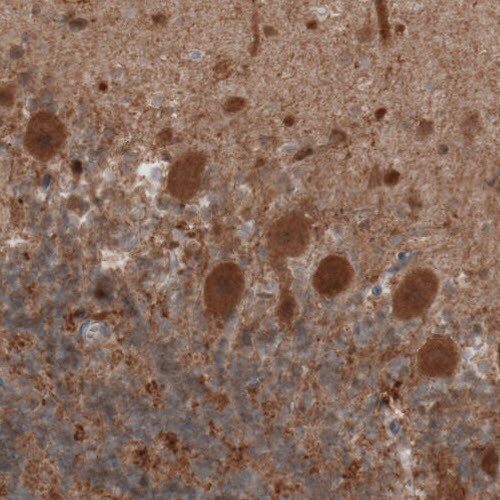 UCH-L1/PGP9.5 Antibody (CL3210) - BSA Free Immunohistochemistry-Paraffin: UCH-L1/PGP9.5 Antibody (CL3210) [NBP2-46621]