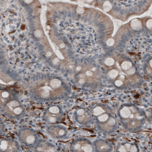 UCH-L1/PGP9.5 Antibody (CL3210) - BSA Free Immunohistochemistry-Paraffin: UCH-L1/PGP9.5 Antibody (CL3210) [NBP2-46621]