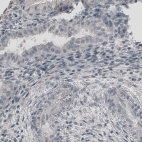 UCH-L1/PGP9.5 Antibody (CL3210) - BSA Free Immunohistochemistry-Paraffin: UCH-L1/PGP9.5 Antibody (CL3210) [NBP2-46621]