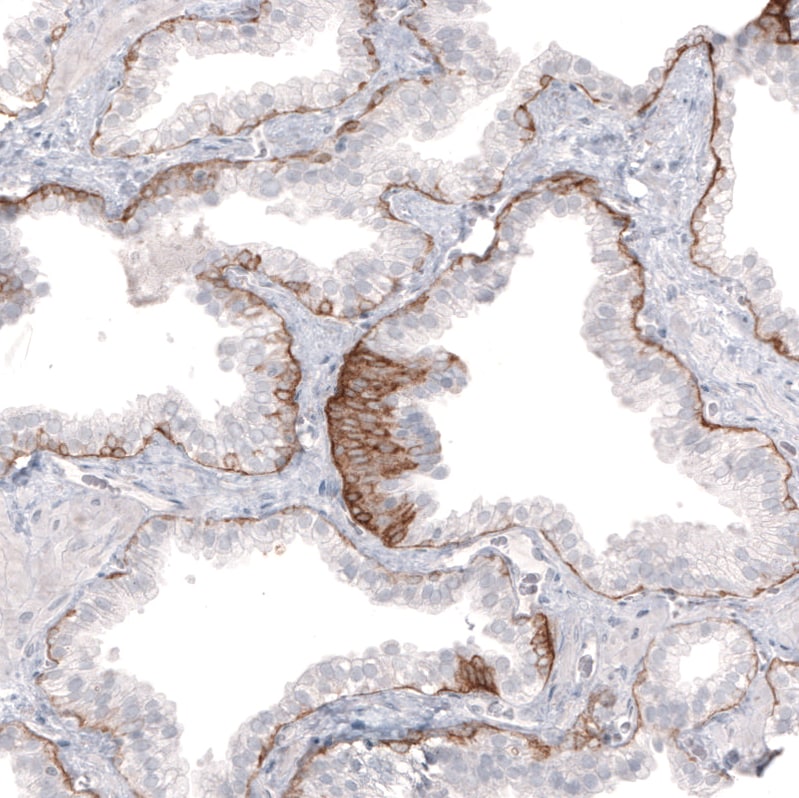 Laminin beta 3 Antibody (CL3353) - BSA Free Immunohistochemistry-Paraffin: Laminin beta 3 Antibody (CL3353) [NBP2-46622]