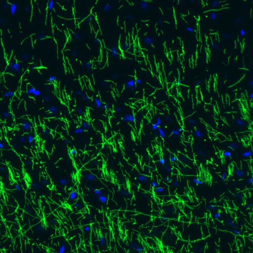 MBP Antibody (CL2819) - BSA Free Immunohistochemistry-Paraffin: MBP Antibody (CL2819) [NBP2-46630]
