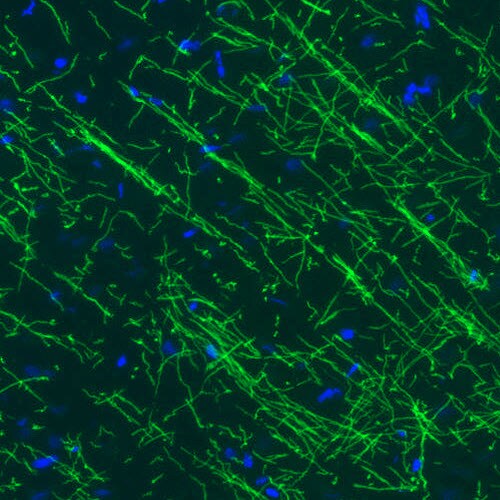 MBP Antibody (CL2819) - BSA Free Immunohistochemistry-Paraffin: MBP Antibody (CL2819) [NBP2-46630]
