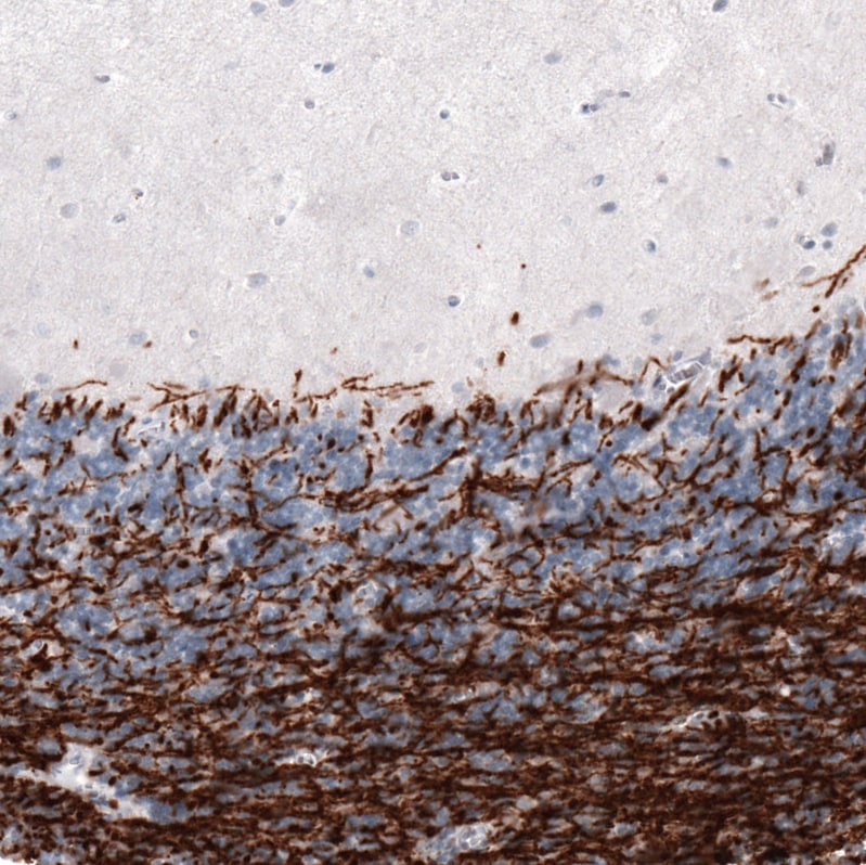 MBP Antibody (CL2829) - BSA Free Immunohistochemistry: MBP Antibody (CL2829) [NBP3-52461]