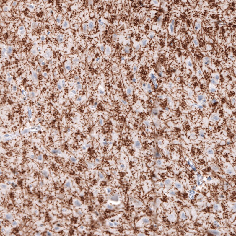 MBP Antibody (CL2829) - BSA Free Immunohistochemistry: MBP Antibody (CL2829) [NBP3-52461]