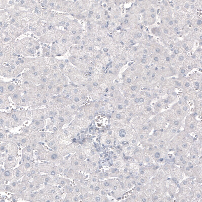 MBP Antibody (CL2829) - BSA Free Immunohistochemistry: MBP Antibody (CL2829) [NBP3-52461]