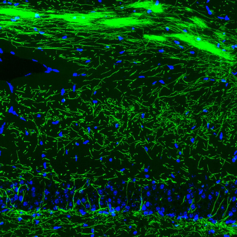 MBP Antibody (CL2829) - BSA Free Immunohistochemistry: MBP Antibody (CL2829) [NBP3-52461]