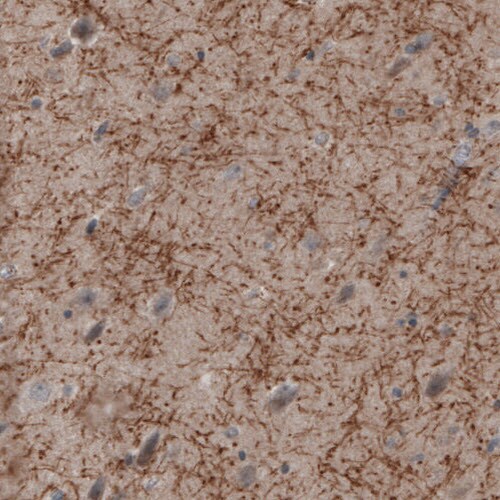 MOG Antibody (CL2852) - BSA Free Immunohistochemistry: MOG Antibody (CL2852) [NBP3-52462]