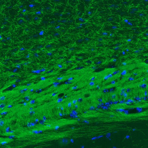 MOG Antibody (CL2852) - BSA Free Immunohistochemistry: MOG Antibody (CL2852) [NBP3-52462]