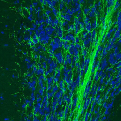 MOG Antibody (CL2852) - BSA Free Immunohistochemistry: MOG Antibody (CL2852) [NBP3-52462]