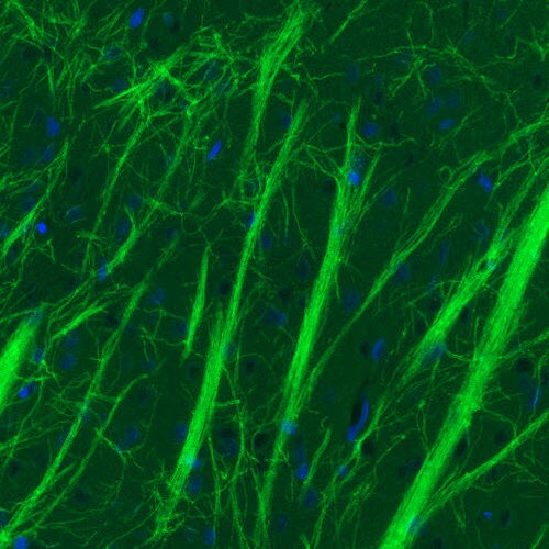 MOG Antibody (CL2852) - BSA Free Immunohistochemistry: MOG Antibody (CL2852) [NBP3-52462]
