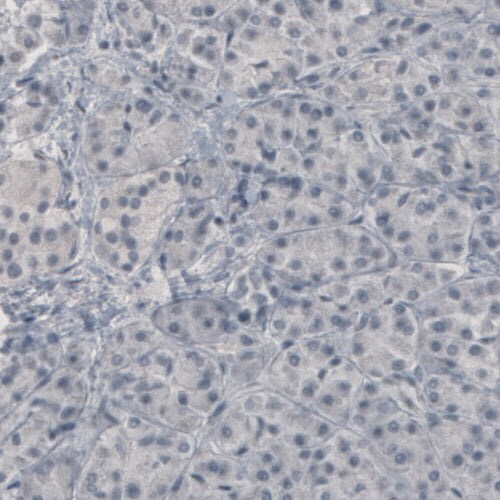 GAD1/GAD67 Antibody (CL2911) - BSA Free Immunohistochemistry-Paraffin: GAD1/GAD67 Antibody (CL2911) [NBP2-46637]