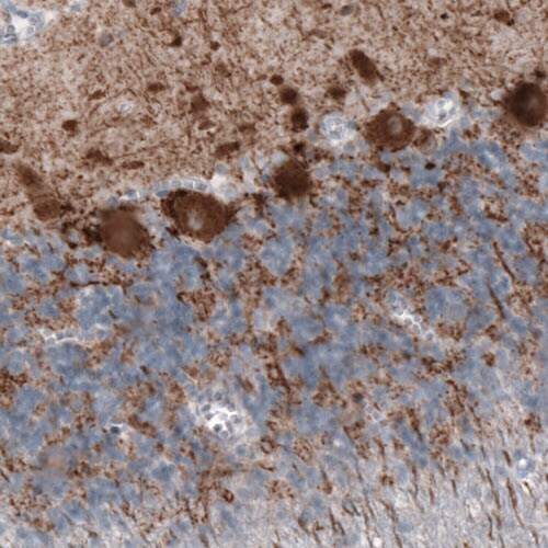 GAD1/GAD67 Antibody (CL2911) - BSA Free Immunohistochemistry-Paraffin: GAD1/GAD67 Antibody (CL2911) [NBP2-46637]