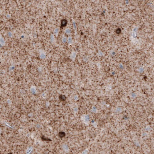 GAD1/GAD67 Antibody (CL2911) - BSA Free Immunohistochemistry-Paraffin: GAD1/GAD67 Antibody (CL2911) [NBP2-46637]