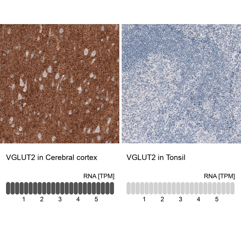 VGLUT2 Antibody (CL2921) - BSA Free Immunohistochemistry: VGLUT2 Antibody (CL2921) [NBP3-52463]