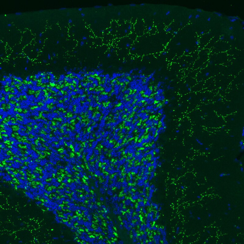 VGLUT2 Antibody (CL2921) - BSA Free Immunohistochemistry: VGLUT2 Antibody (CL2921) [NBP3-52463]