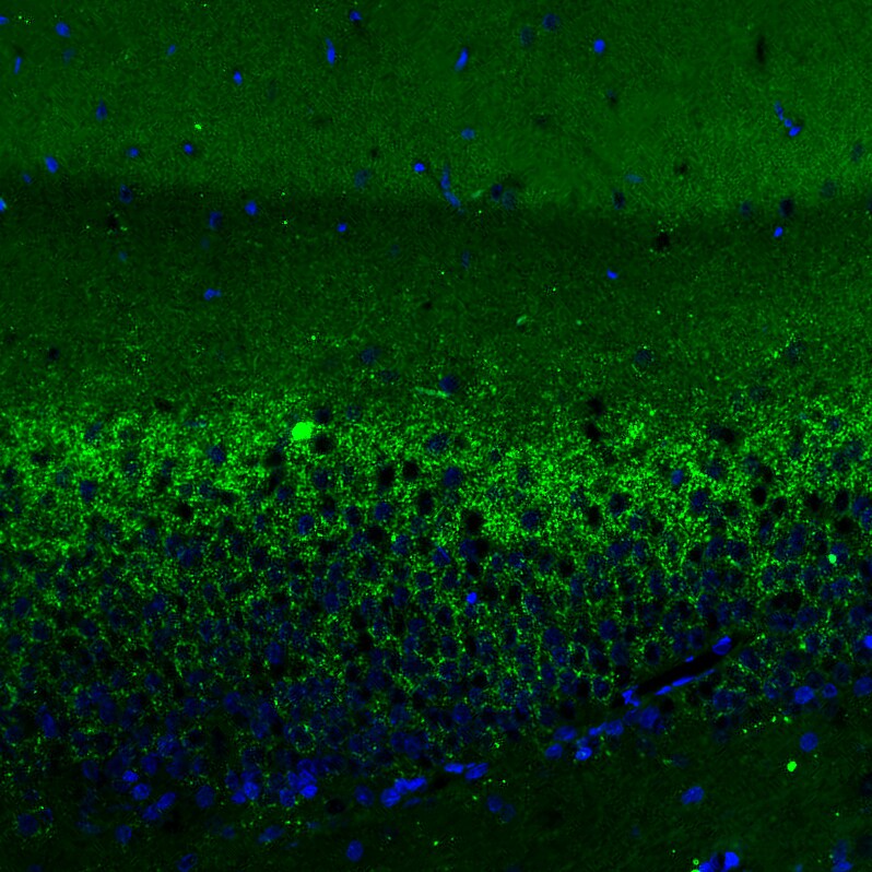 VGLUT2 Antibody (CL2921) - BSA Free Immunohistochemistry: VGLUT2 Antibody (CL2921) [NBP3-52463]