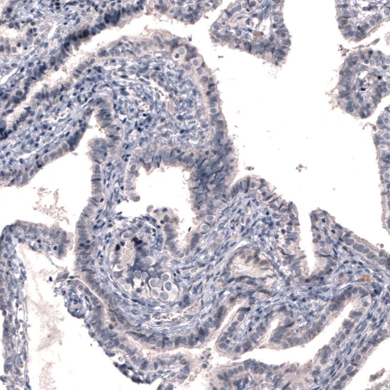 Dopa Decarboxylase/DDC Antibody (CL2962) - BSA Free Immunohistochemistry: Dopa Decarboxylase/DDC Antibody (CL2962) [NBP3-52464]