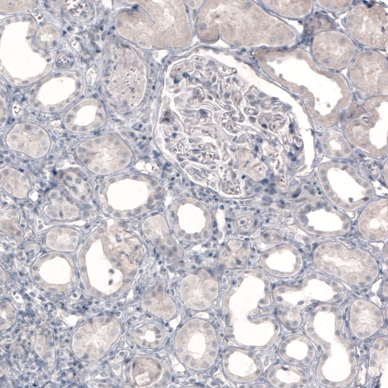 SLC6A2/NET/Noradrenaline transporter Antibody (CL3063) - BSA Free Immunohistochemistry: SLC6A2/NET/Noradrenaline transporter Antibody (CL3063) [NBP3-52466]