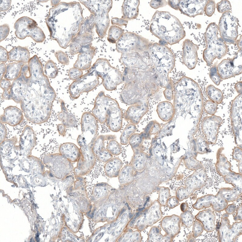 SLC6A2/NET/Noradrenaline transporter Antibody (CL3063) - BSA Free Immunohistochemistry: SLC6A2/NET/Noradrenaline transporter Antibody (CL3063) [NBP3-52466]