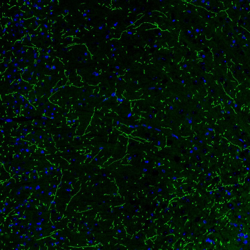 SLC6A2/NET/Noradrenaline transporter Antibody (CL3063) - BSA Free Immunohistochemistry: SLC6A2/NET/Noradrenaline transporter Antibody (CL3063) [NBP3-52466]