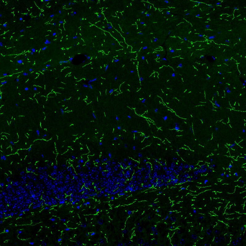 SLC6A2/NET/Noradrenaline transporter Antibody (CL3063) - BSA Free Immunohistochemistry: SLC6A2/NET/Noradrenaline transporter Antibody (CL3063) [NBP3-52466]