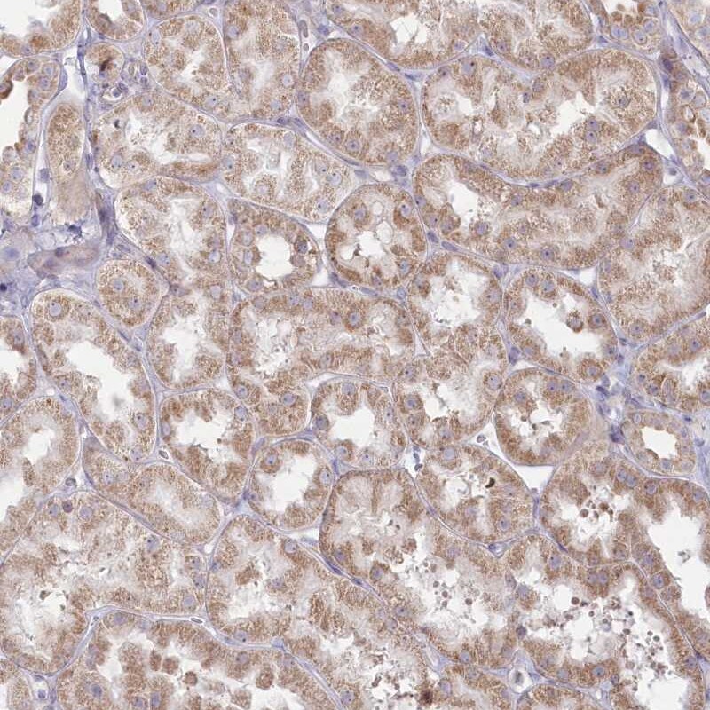 MTG1 Antibody - BSA Free Immunohistochemistry: MTG1 Antibody - BSA Free [NBP2-46659]
