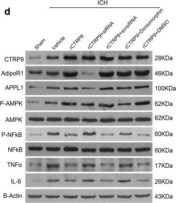CTRP9/C1qTNF9 Antibody