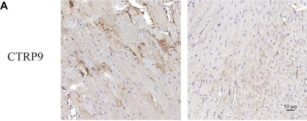 CTRP9/C1qTNF9 Antibody - BSA Free
