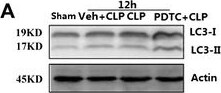 LC3B Antibody (1251A) - BSA Free