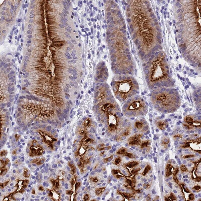 SPIRE2 Antibody - BSA Free Immunohistochemistry-Paraffin: SPIRE2 Antibody [NBP2-47261]