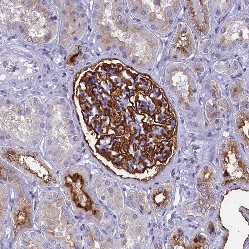 SPIRE2 Antibody - BSA Free Immunohistochemistry-Paraffin: SPIRE2 Antibody [NBP2-47261]