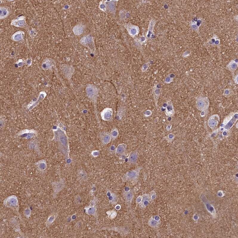 SPIRE2 Antibody - BSA Free Immunohistochemistry-Paraffin: SPIRE2 Antibody [NBP2-47261]