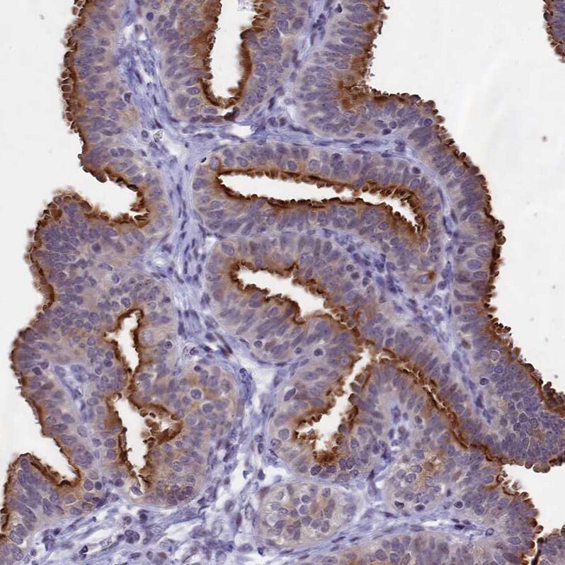 SPIRE2 Antibody - BSA Free Immunohistochemistry-Paraffin: SPIRE2 Antibody [NBP2-47261]