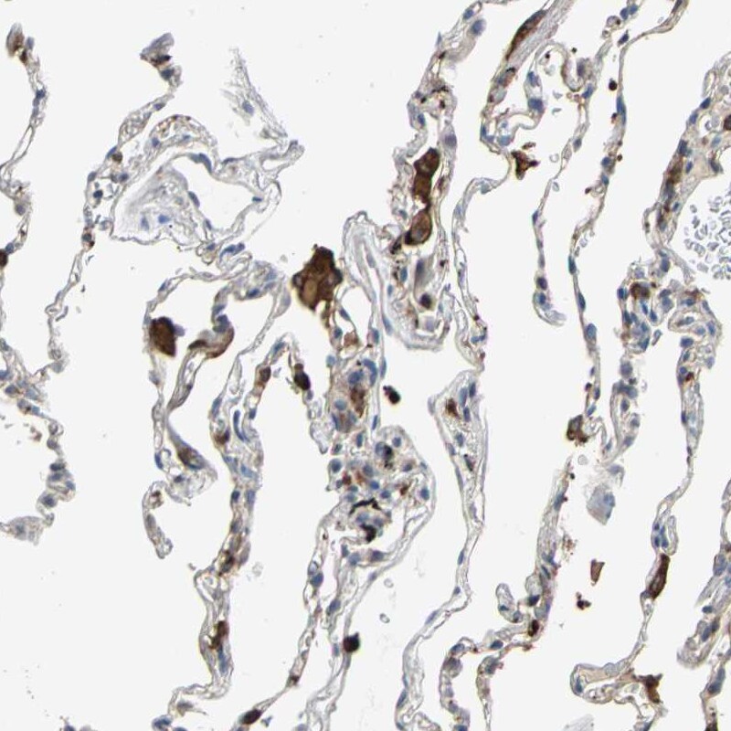 SCAP2 Antibody